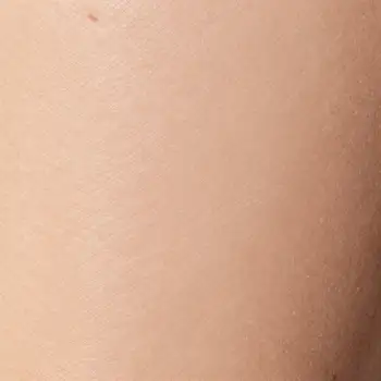 Close-up of Skin Texture human skin
