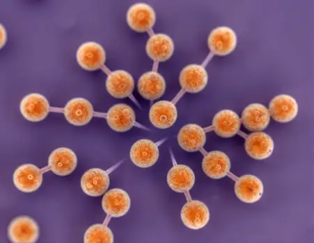 Microscopic Orange Spheres in Star Pattern sem